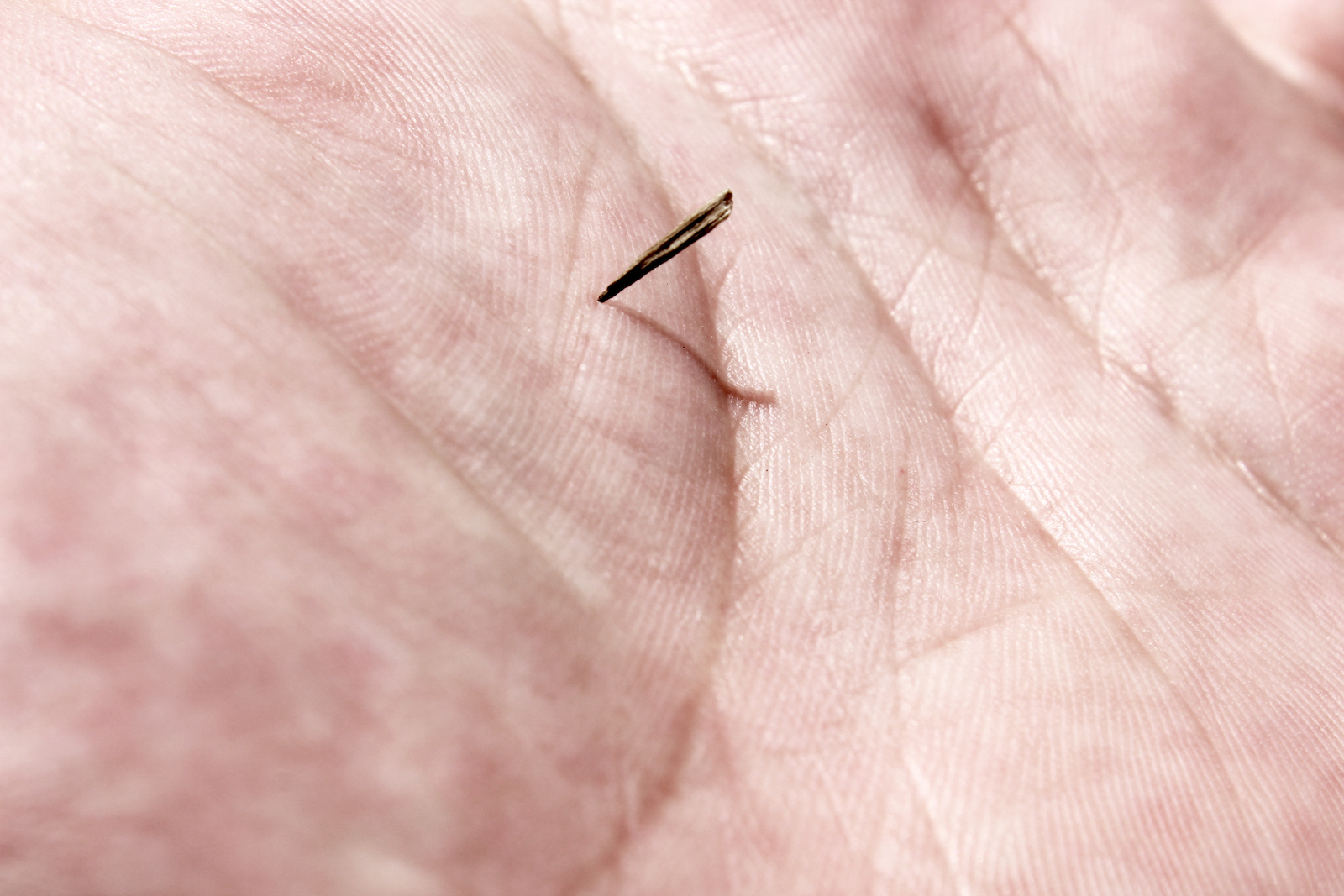 A splinter or thorn in the hand of a close-up.
