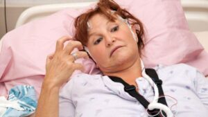Stroke seizures