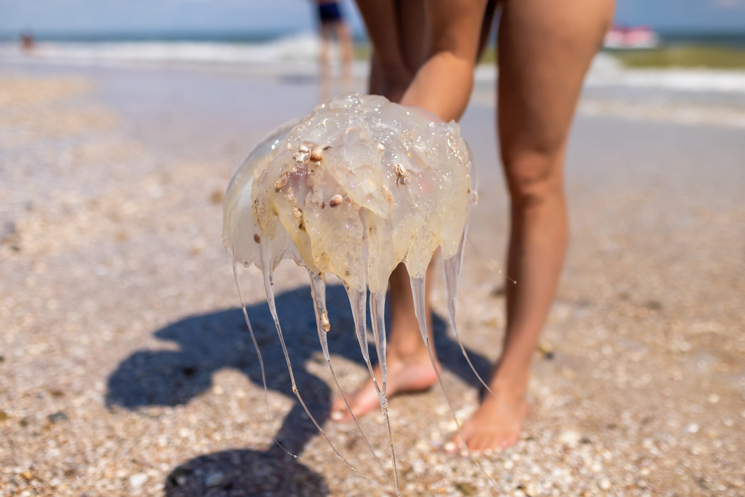 Woman holding jellyfish sting while standing on the coast