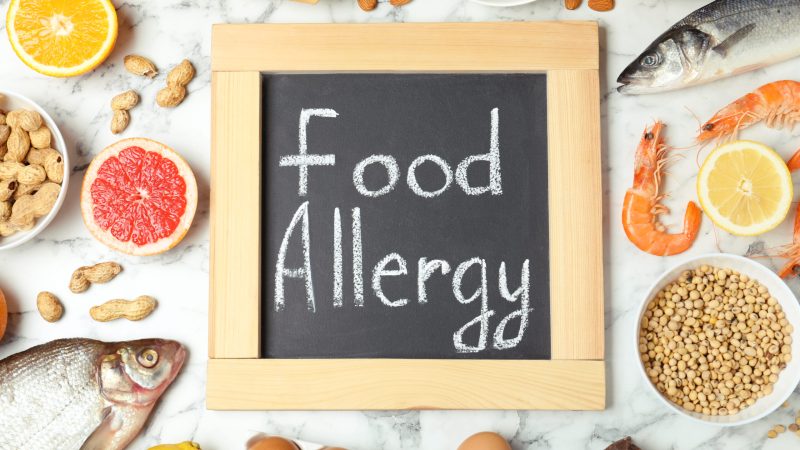 Chalkboard with words FOOD ALLERGY and different products on white marble table, flat lay food allergy first aid