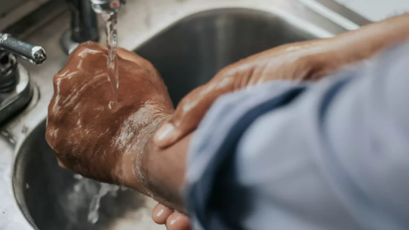 A person holding their hand under running water after suffering a burn. First aid for burns.