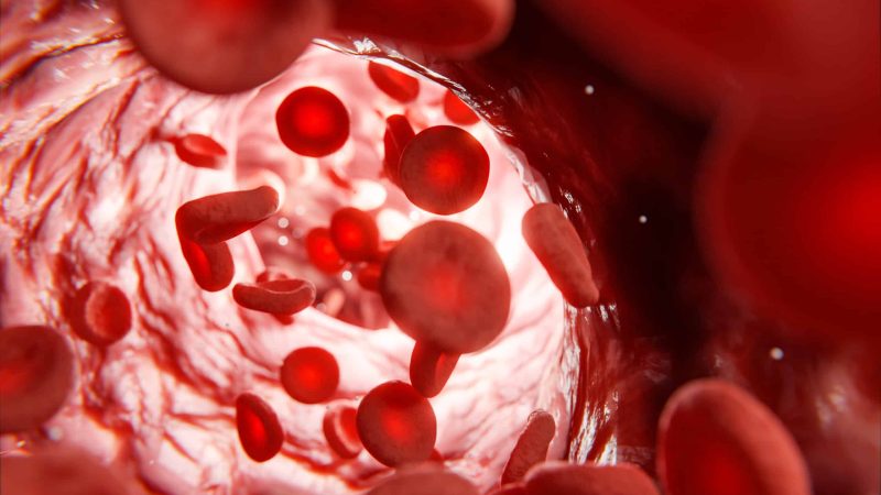blood clot hypotension