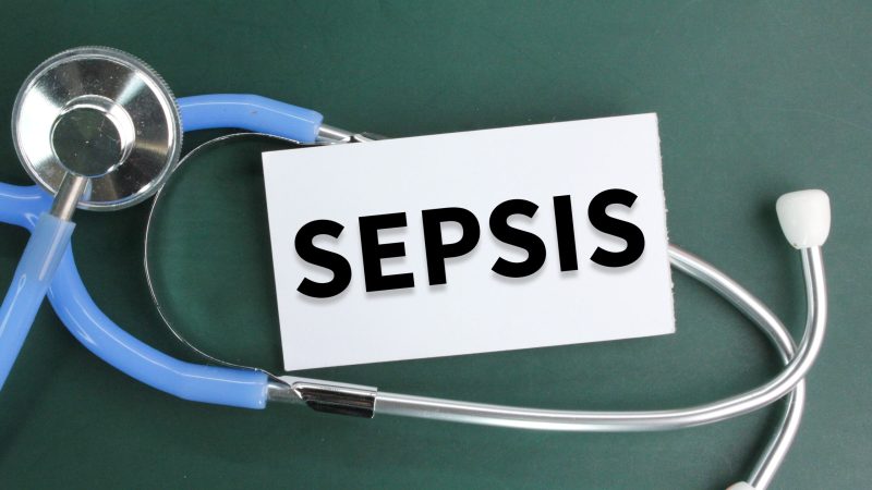 septic shock visualisation